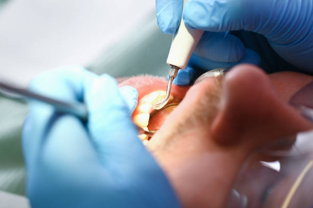 Best Same-Day Emergency Dentist in Flat Rock, MI