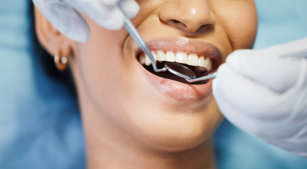 Best Emergency Wisdom Teeth Removal in Flat Rock, MI