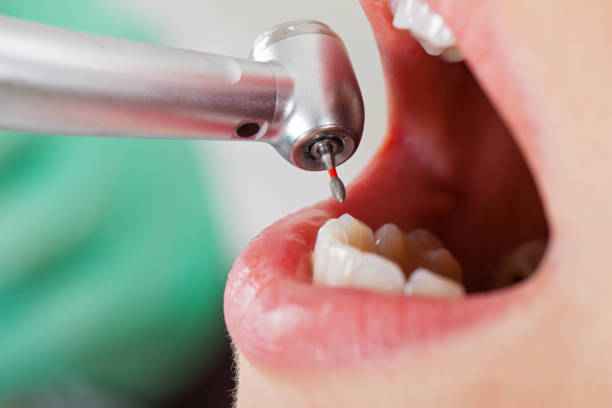 Best Emergency Treatment for Toothache in Flat Rock, MI